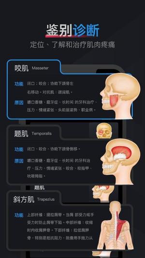 肌肉激痛点图谱截图
