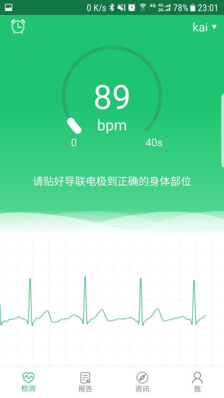 极简心电截图